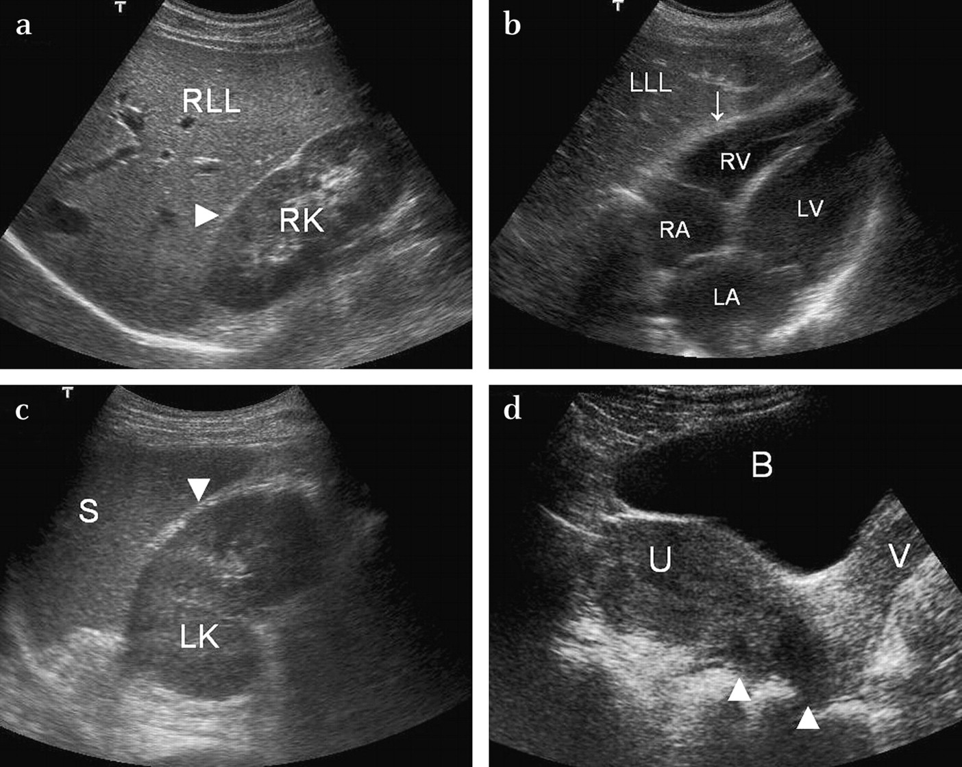 Best Sonography Centre in Ahmedabad