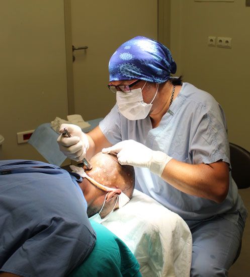 Hair Transplant in Turkey