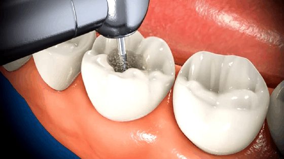 India Dental Tourism Profile Creation