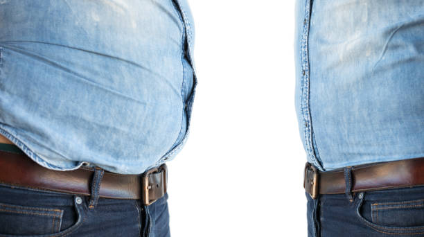 BENEFITS OF BARIATRIC SURGERY