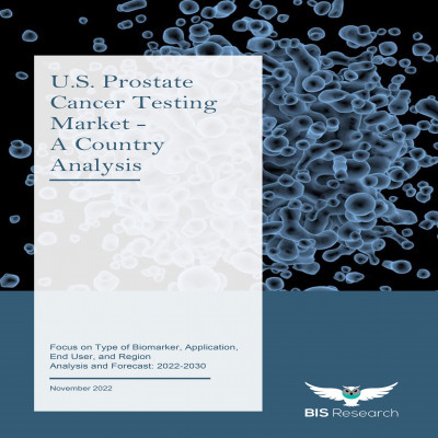 U.S. Prostate Cancer Testing Market Trends, Share, Growth Rate, Opportunities and Industry Forecast 2022-2030