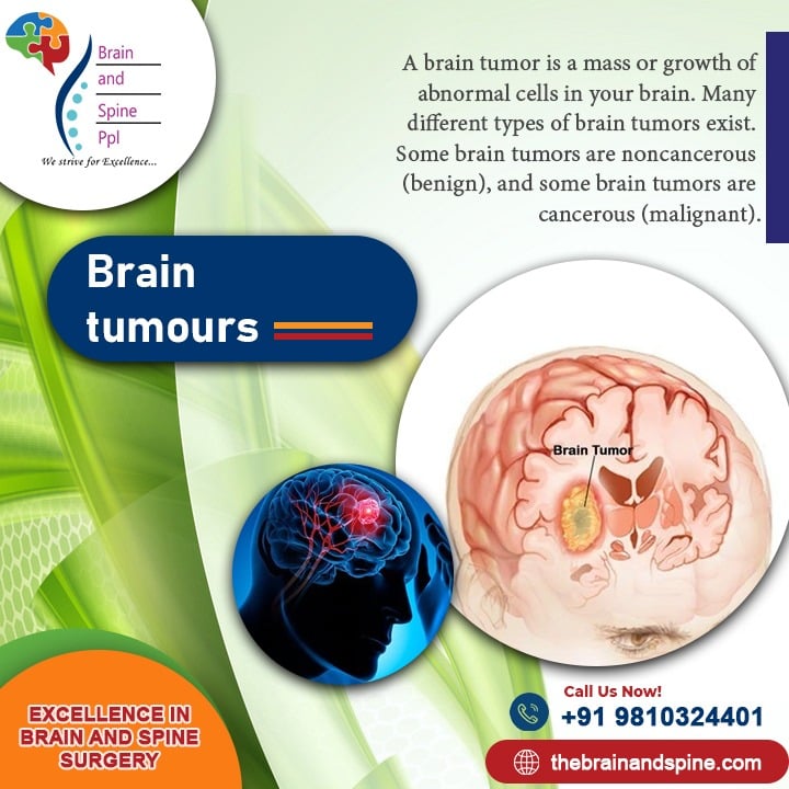 Brain tumour surgery in Delhi Best hospital 2022 Thebrainandspine