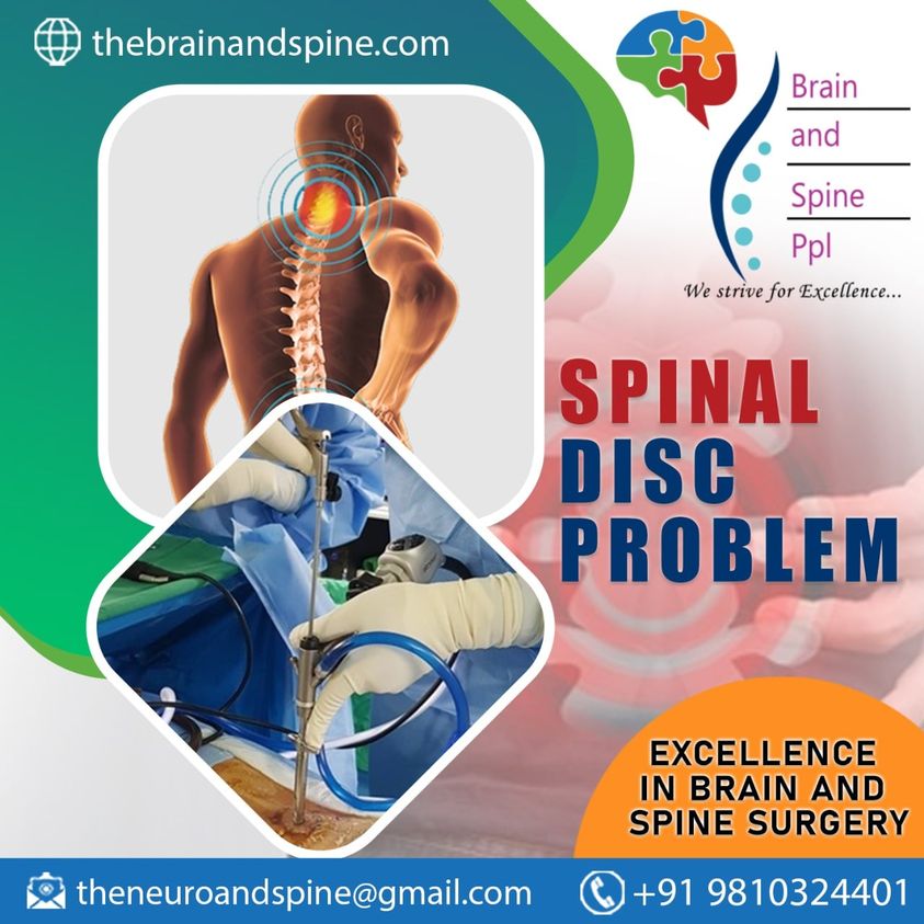 How to heal a Herniated Disc Surgery in Delhi quickly Thebrainandspine