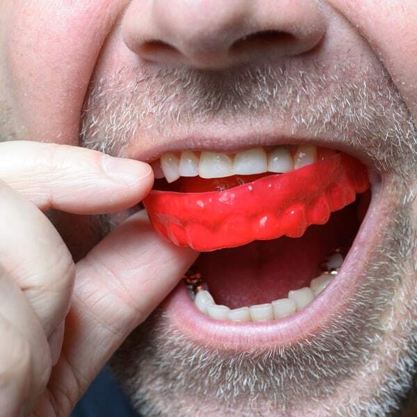The Benefits of Wearing a Mouthguard During Exercise and Physical Activity