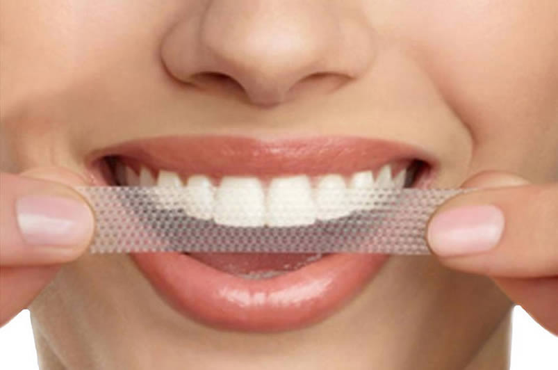 Crest 3D White Strips