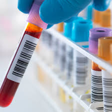 HLA Testing Market 2021 Analysis Report by Recent Developments and Emerging Technologies Till 2027