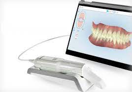 3D Intraoral Scanners Market Size, Status, Growth | Industry Analysis Report 2020-2027