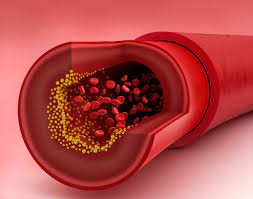 Report on Vascular Prostheses Market Research 2027 - Value Market Research