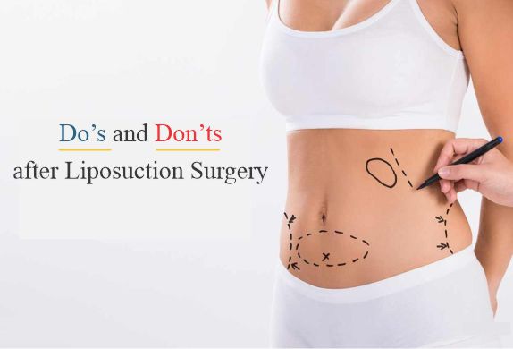 Find Best Liposuction Surgeon in Delhi?