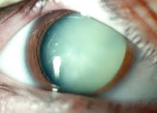 Best Eye Care Centres In Delhi | Best Eye Hospital In Delhi