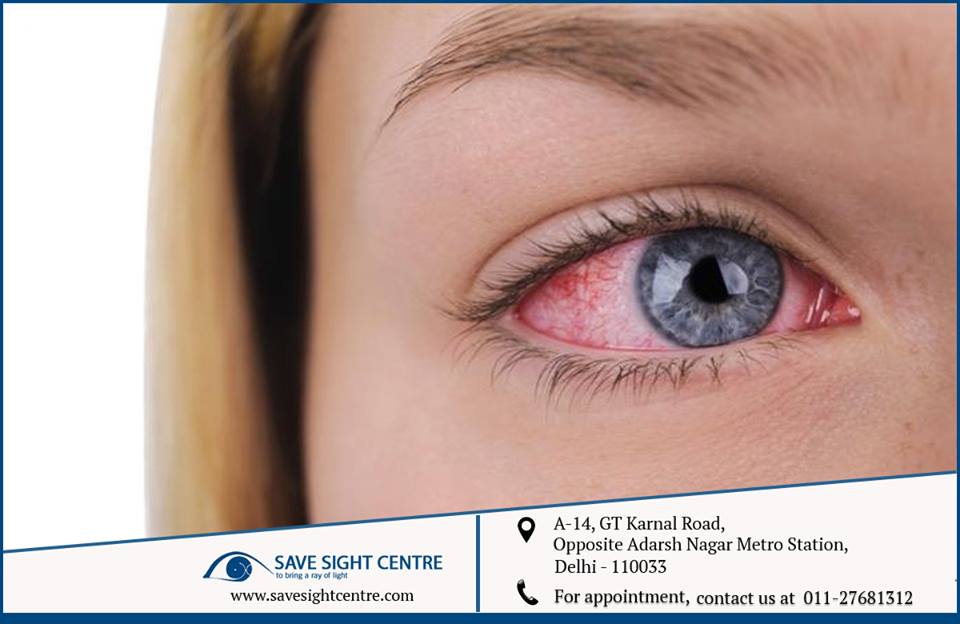 Pediatric Ophthalmology in Shalimar Bagh| Model Town