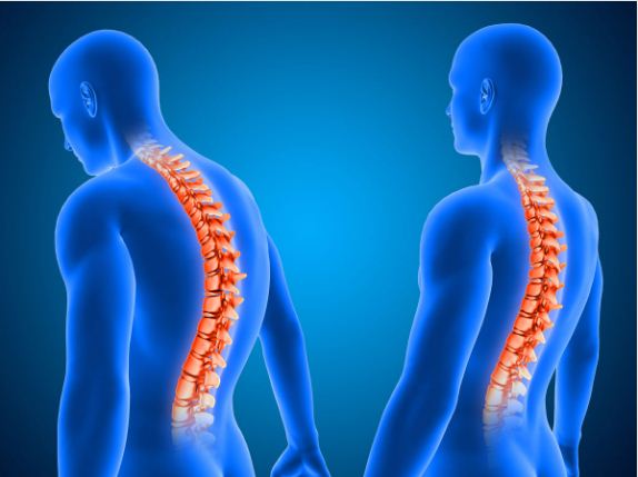 Latest Spinal Surgeries for Scoliosis