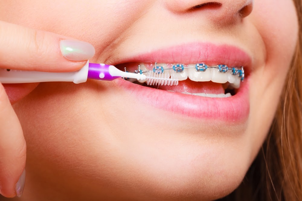 Consult the Best Dentist in Gurgaon | Contact Us