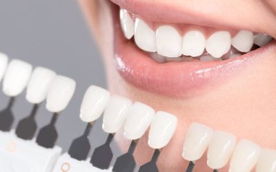 Finding a Clinic for Teeth Whitening in South Delhi