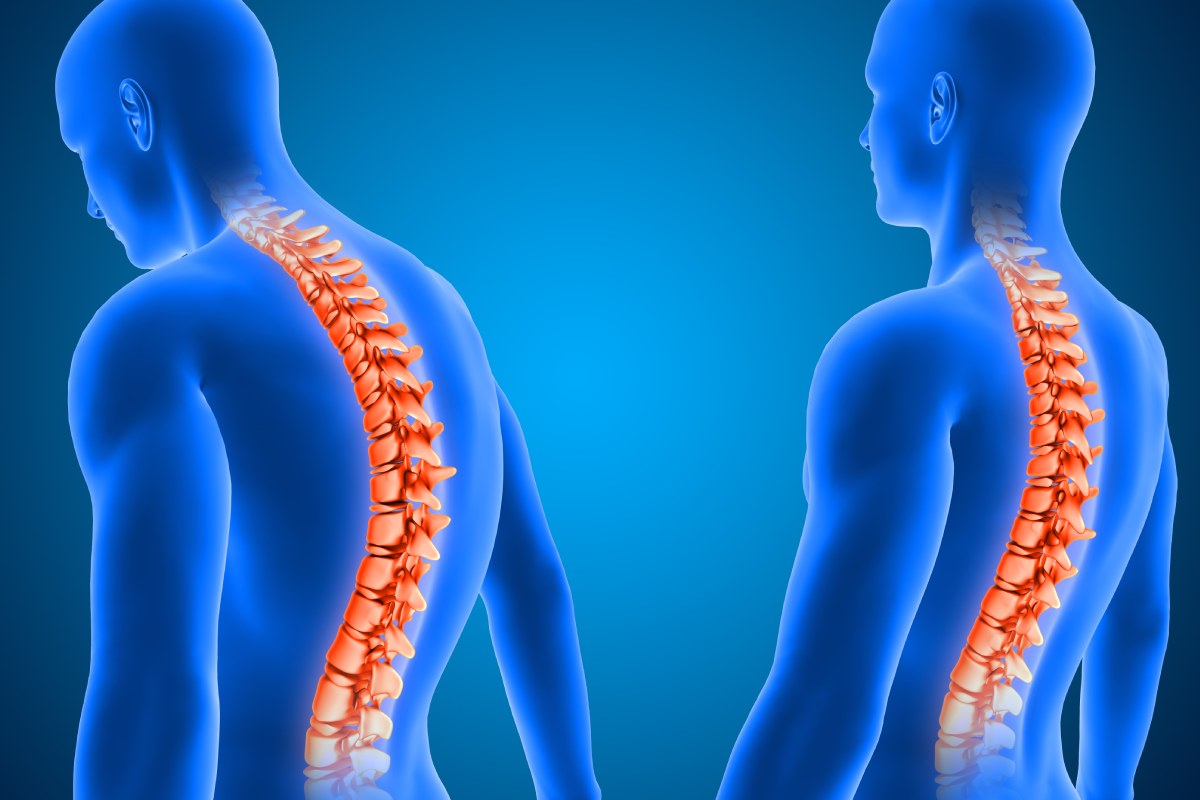 Best Spine & Neuro surgeon Hospital In Chanda Nagar