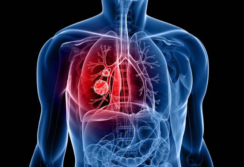 How Covid-19 Affects your Lungs | COVID-19 Lung Damage
