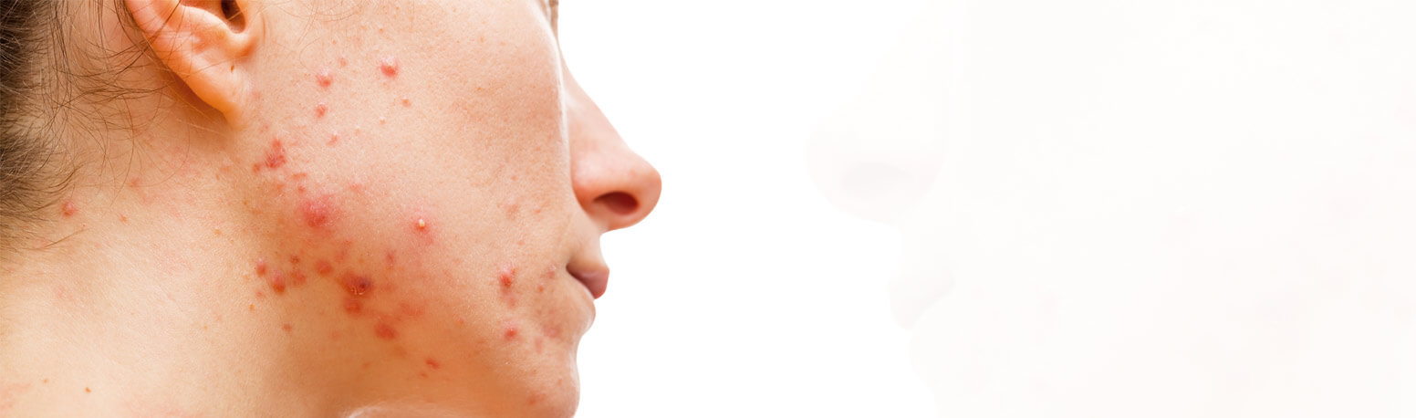 Advanced Anti-Aging Treatments for Youthful Skin