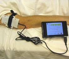 Muscle Oxygen Monitors Market Report 2022 | Global Industry Trends, Forecasts and Opportunity Assessment Till 2028