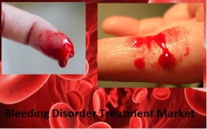 Global Bleeding Disorders Treatment Market 2021 Analysis Report by Recent Developments and Emerging Technologies Till 2027