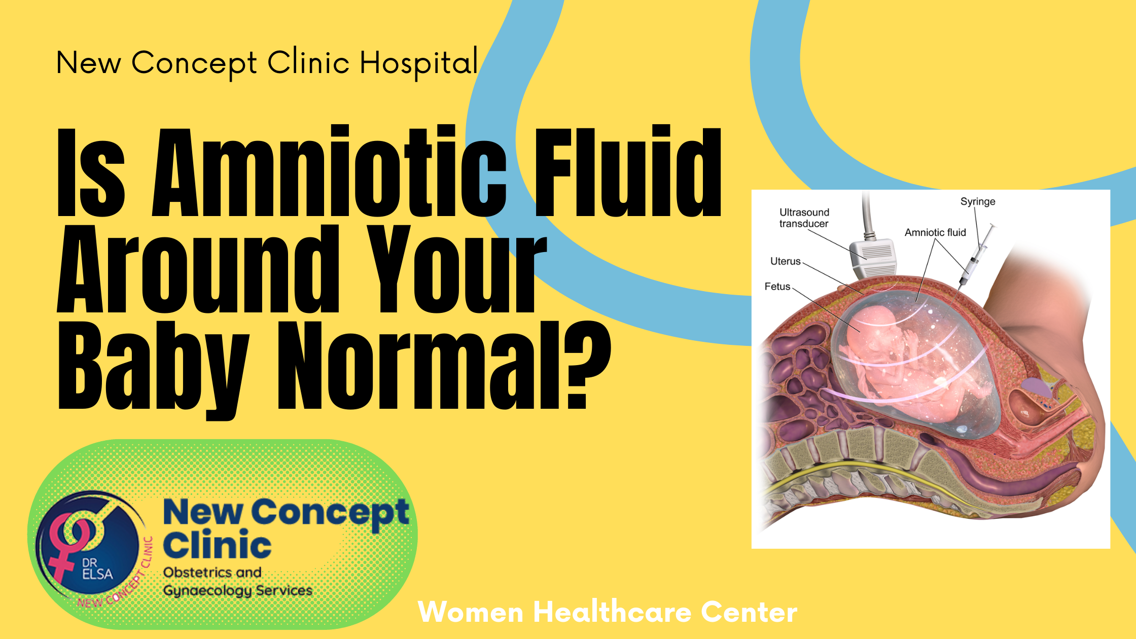 Is Amniotic Fluid Around Your Baby Normal