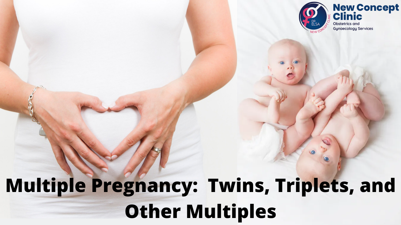 Multiple Pregnancy: Twins, Triplets, and Other Multiples 