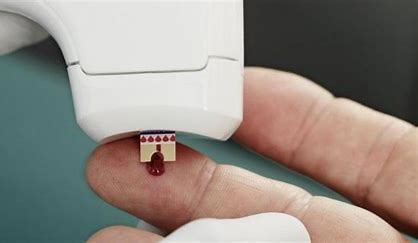 Global Coagulation/Hemostasis Analyzer Market 2021 Analysis Report by Recent Developments and Emerging Technologies Till 2027