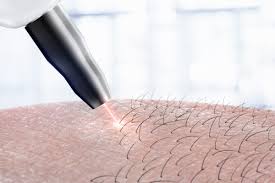 Cold Laser Therapy Market 2022: Expeditious Growth Expected in Coming Years