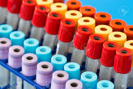 DNA Test Kits Market Rising Trends, Demands and Business Outlook 