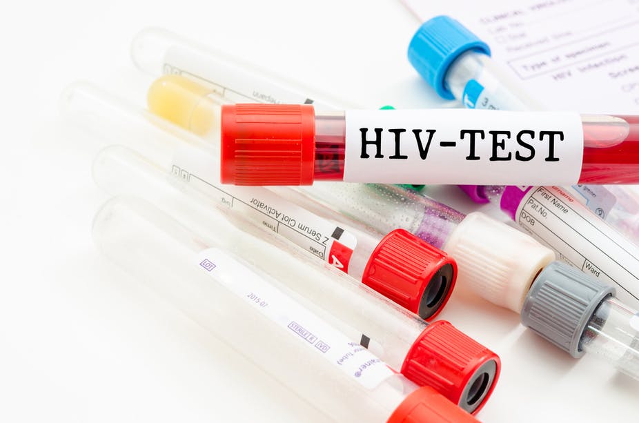 HIV Testing in Tampa – Confidential & Accurate