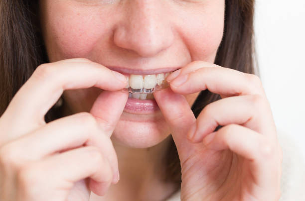 Transform Your Smile with Invisalign in Kennesaw: A Comprehensive Guide