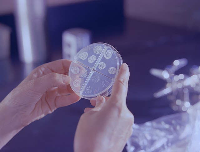Antimicrobial Susceptibility Testing Market Analysis by Share, Size, Supply and Demand 2021-2025