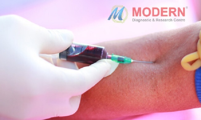 Best Home Sample Collection Services in India - MDRC India