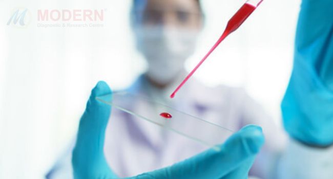 Affordable Best Blood Test Packages - MDRC India