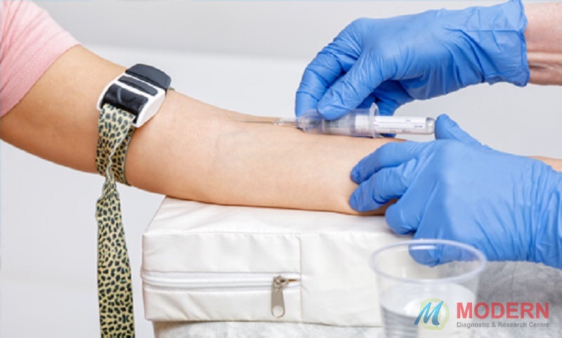 How effective is the Blood Sample Collection Facility for Pathology Tests?