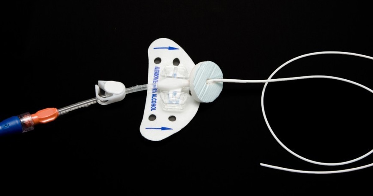 Exploring the Types and Uses of Indwelling Catheters