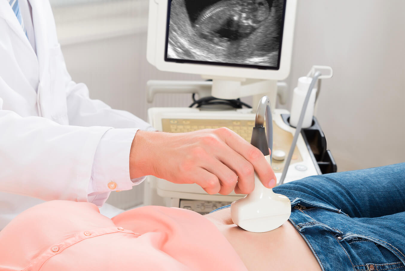 Thing to Know that Non-invasive Prenatal Testing (NIPT)
