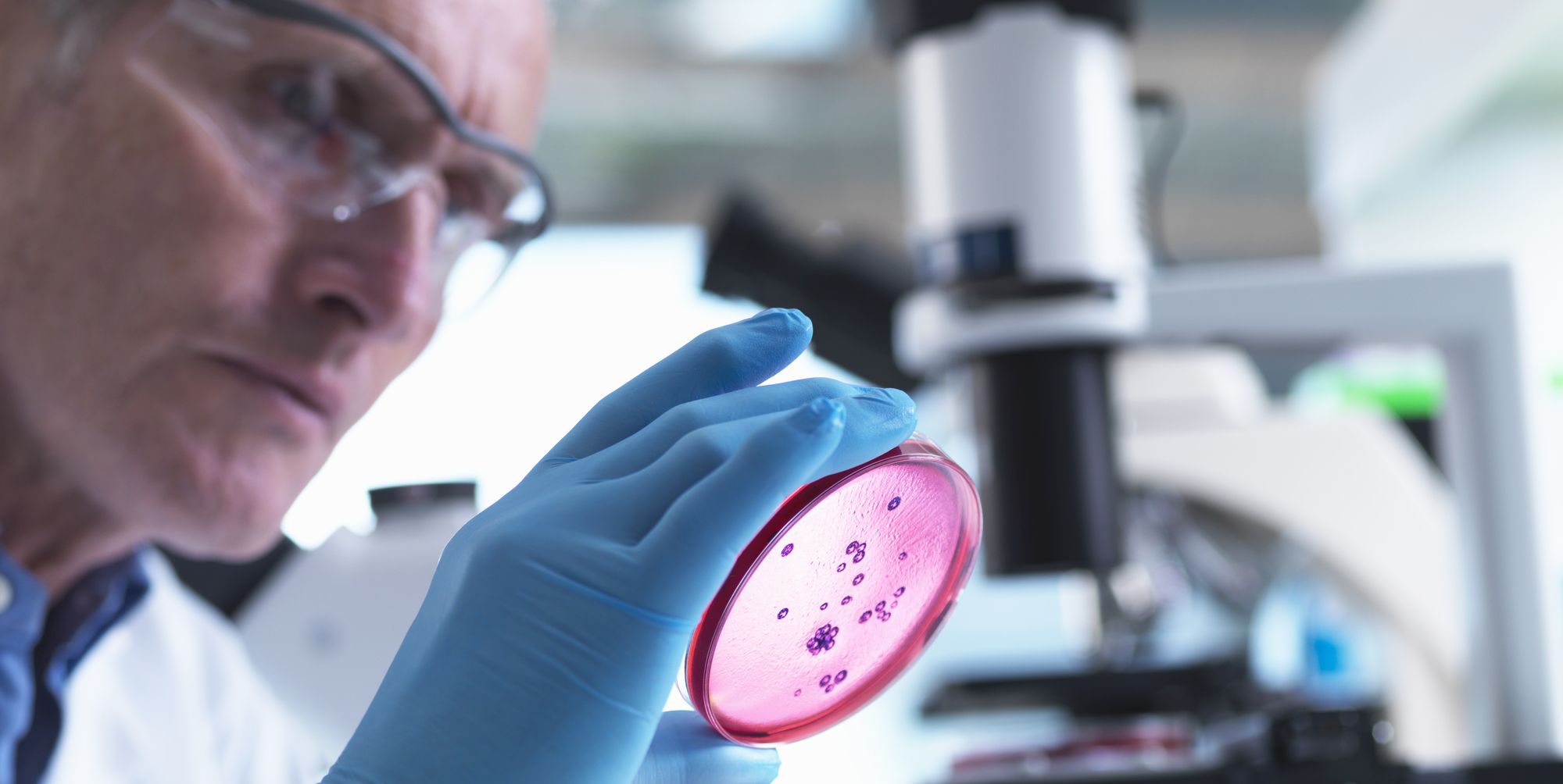 The Importance of Early Diagnosis in Monkeypox Treatment