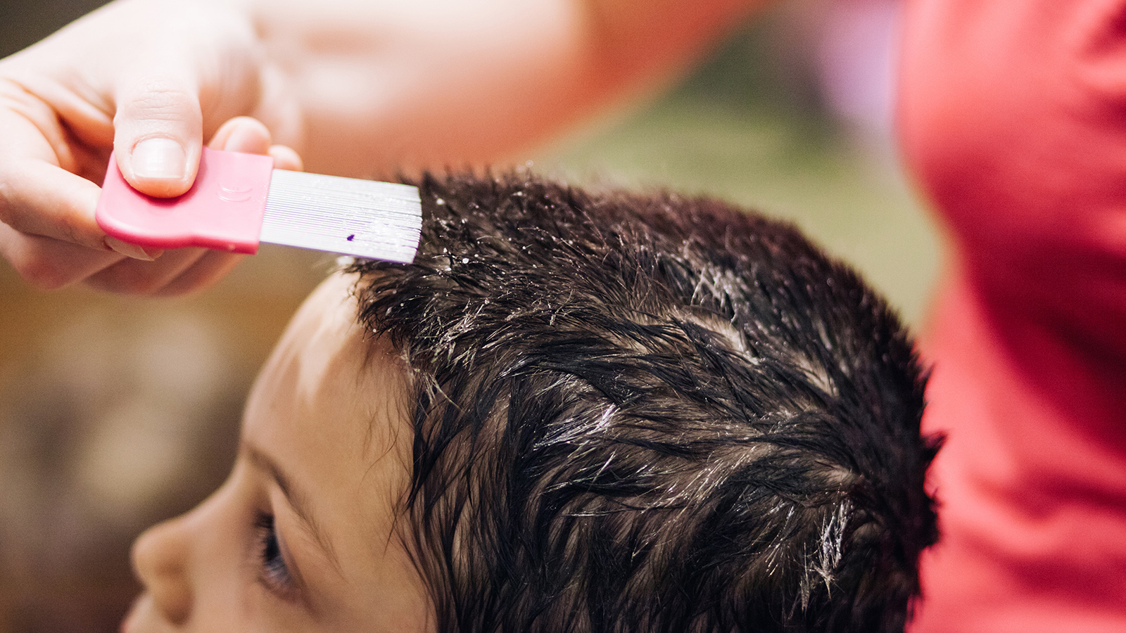 Global Lice Treatment Market Key Players