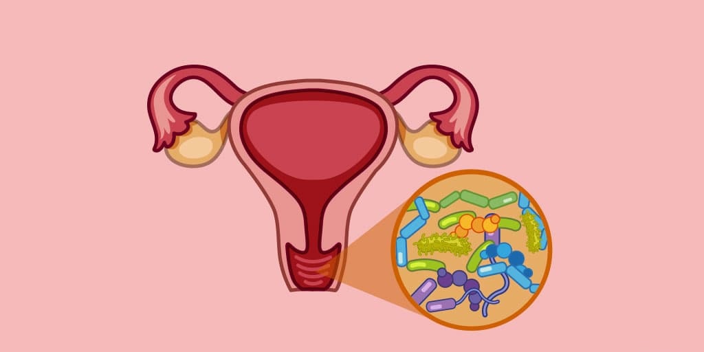 Effective Acute Vulvovaginal Candidiasis Treatment: A Comprehensive Guide