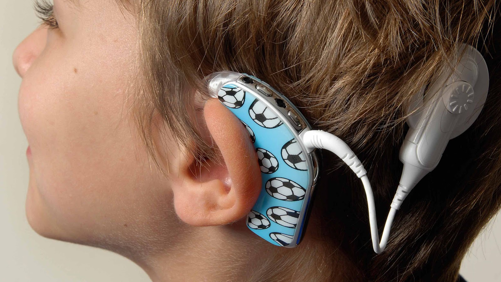 Technological Innovations in Middle Ear Implants Market Expansion