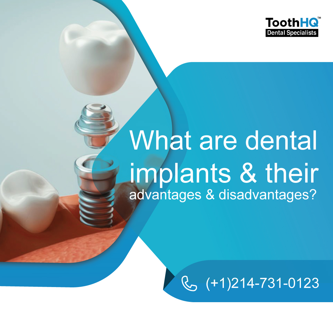 What are Dental Implants and their advantages and disadvantages?
