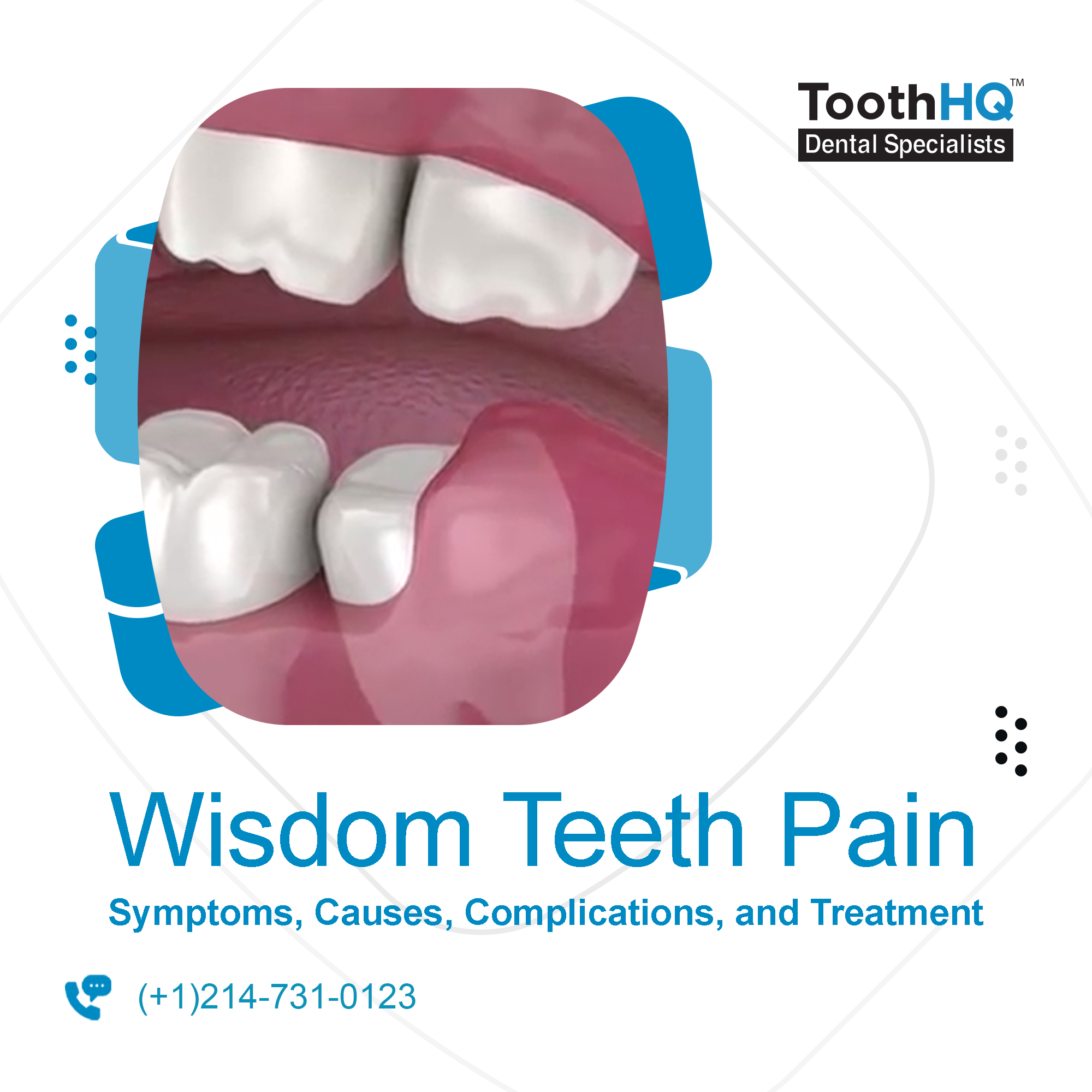 Symptoms You Need To Get Wisdom Teeth Removed