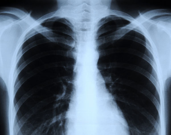 X-Ray Imaging Market 2021 Analysis Report by Recent Developments and Emerging Technologies Till 2027