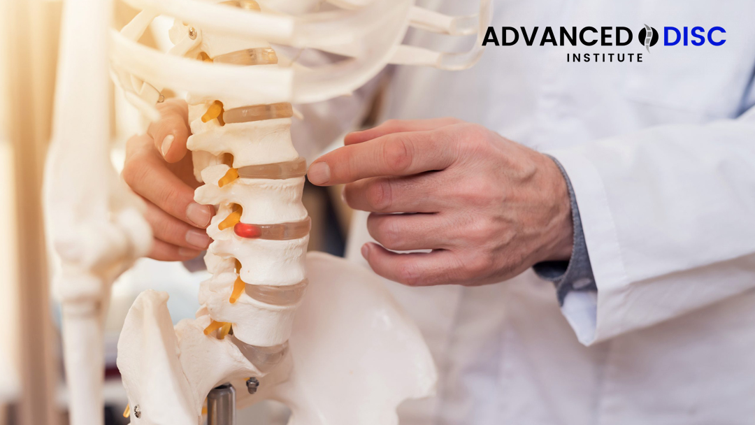 Can I Seek Spinal Stenosis Treatment Without Surgery Fargo ND?