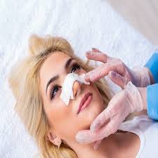 Rhinoplasty Cost in Islamabad