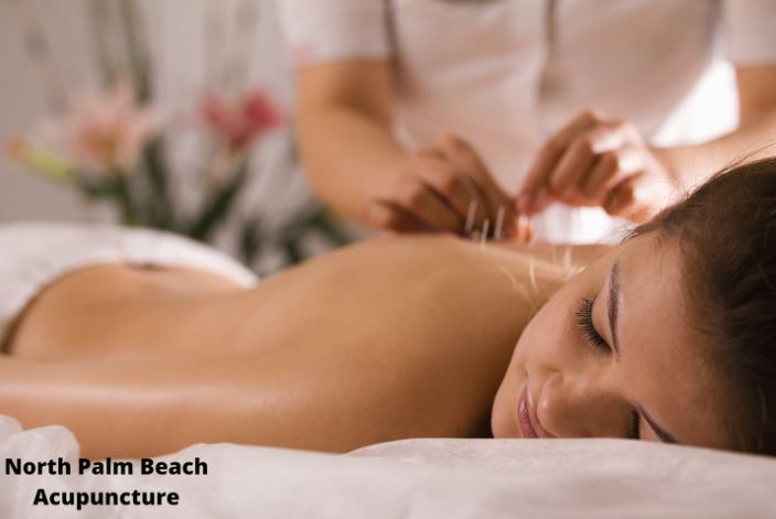 Things To Know Before You Reach Acupuncture Clinic For The First Session