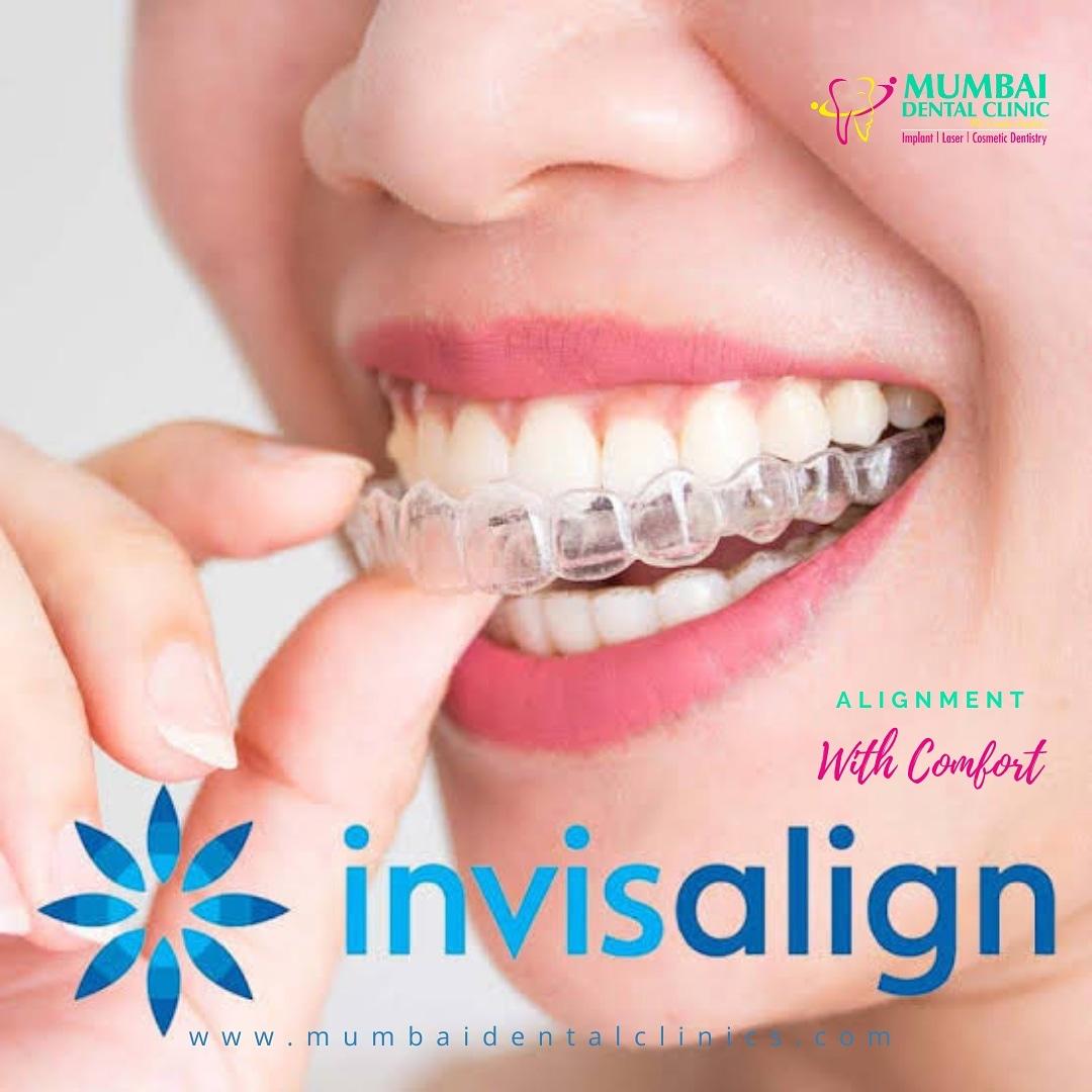 The top seven safety precautions to follow while using aligners.