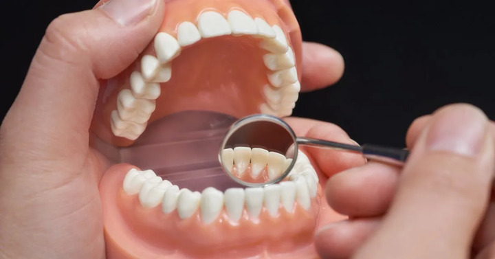 Dentists Can Tell You the Difference Between Dentures and Dental Implants