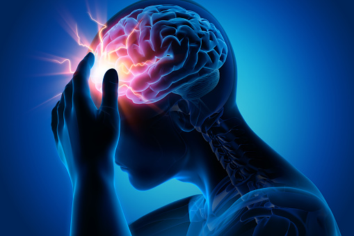 Common Types of Headaches & When to See a Doctor