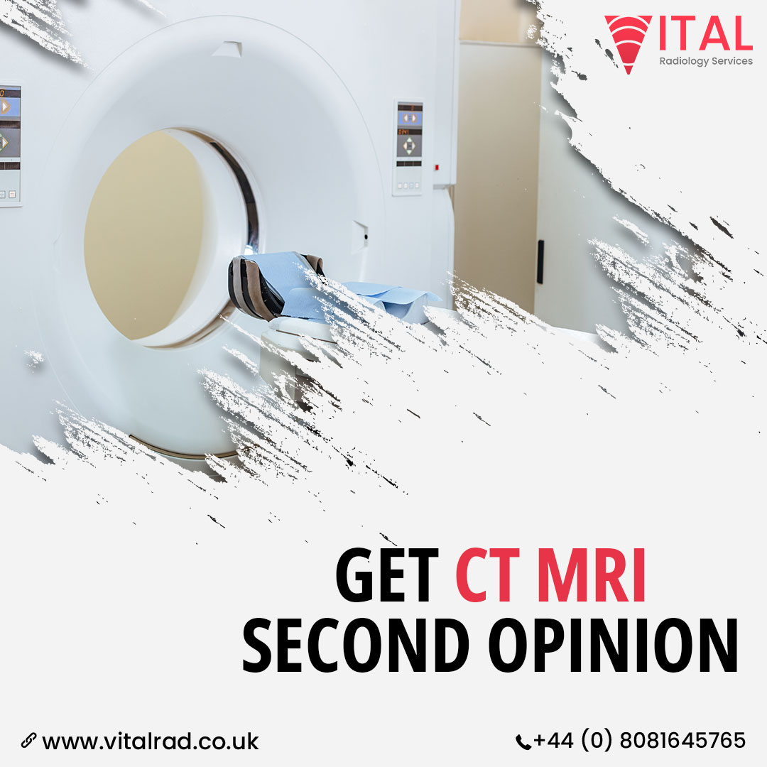 Get CT MRI Second Opinion  
